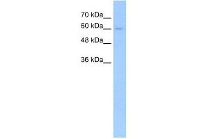 Western Blotting (WB) image for anti-Transforming Growth Factor, beta Receptor II (70/80kDa) (TGFBR2) (N-Term) antibody (ABIN2781999)
