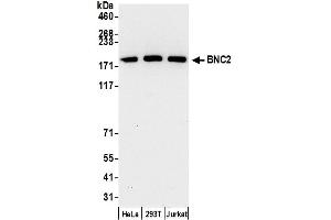 anti-Basonuclin 2 (BNC2) (AA 350-400) antibody