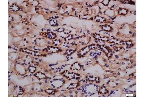 Immunohistochemistry (Paraffin-embedded Sections) (IHC (p)) image for anti-Nephrosis 1, Congenital, Finnish Type (Nephrin) (NPHS1) (pTyr1217) antibody (ABIN2559555)