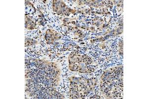 IHC analysis of SNRPD2 using anti-SNRPD2 antibody (ABIN7598963).