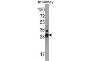 Western Blotting (WB) image for anti-Dimethylarginine Dimethylaminohydrolase 1 (DDAH1) antibody (ABIN3001702)