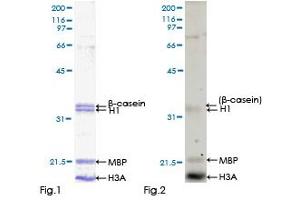 Kinase Activity Assay (KAA) image for Calcium/calmodulin-Dependent Protein Kinase IG (CAMK1G) (AA 1-476) protein (GST tag) (ABIN1347921) (CAMK1G Protein (AA 1-476) (GST tag))