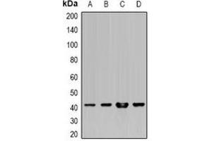 Western blot analysis of HLA-A expression in Hela (A), SW480 (B), HepG2 (C), mouse liver (D) whole cell lysates.