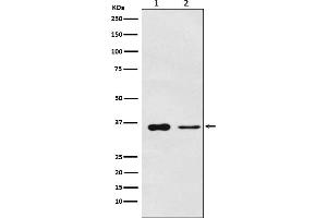 Western blot analysis of PDLIM1 expression in (1) Saos2 cell lysate, (2) Mouse lung lysate.