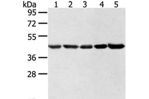 Western blot analysis of Hela lncap NIH/3T3 K562 and 231 cell using WDR77 Polyclonal Antibody at dilution of 1:500 (WDR77 Antikörper)