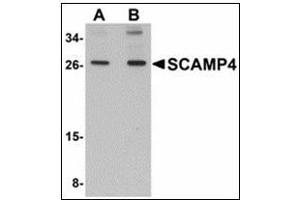 Western blot analysis of SCAMP4 in 3T3 cell lysate with SCAMP4 antibody at (A) 1 and (B) 2 µg/ml. (SCAMP4 Antikörper  (C-Term))