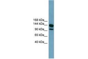 Image no. 1 for anti-Leucine Rich Repeat Containing 66 (LRRC66) (AA 575-624) antibody (ABIN6744784) (LRRC66 Antikörper  (AA 575-624))
