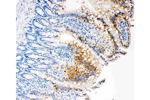 IHC analysis of Caspase-3 (P17)using anti- Caspase-3 (P17)antibody . (Caspase 3 Antikörper  (N-Term))