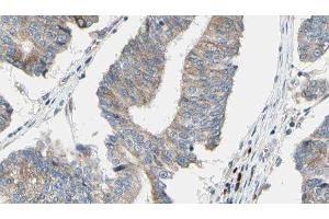 ABIN6276563 at 1/100 staining Human prostate tissue by IHC-P.