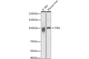 Western blot analysis of extracts of various cell lines, using TFR2 antibody (ABIN6128863, ABIN6149063, ABIN6149064 and ABIN6225172) at 1:1000 dilution. (Transferrin Receptor 2 Antikörper  (AA 582-801))