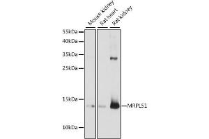 Western blot analysis of extracts of various cell lines, using MRPL51 antibody (ABIN7268577) at 1:1000 dilution. (MRPL51 Antikörper  (AA 1-128))