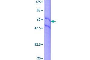 Image no. 1 for Epidermal Growth Factor Receptor (EGFR) (AA 1-405) protein (GST tag) (ABIN1352437)