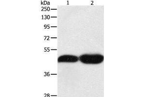 Western Blot analysis of NIH/3T3 and Lncap cell using TEKT1 Polyclonal Antibody at dilution of 1:500 (TEKT1 Antikörper)