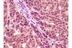Immunohistochemistry (IHC) image for anti-Glycogen Synthase Kinase 3 alpha (GSK3a) (truncated) antibody (ABIN2464059) (GSK3 alpha Antikörper  (truncated))