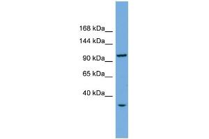 WB Suggested Anti-CHTF18 Antibody Titration: 0.