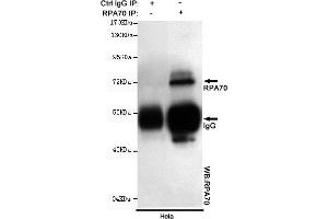 Immunoprecipitation analysis of Hela cell lysates using R mouse mAb. (RPA1 Antikörper)