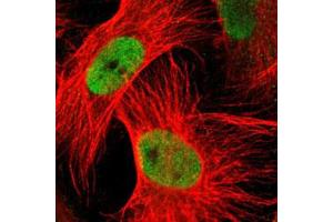 Immunofluorescent staining of U-251 MG with MT3 polyclonal antibody  (Green) shows positivity in nucleus but excluded from the nucleoli.