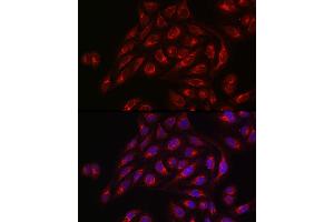 Immunofluorescence analysis of U2OS cells using TLR1 Rabbit pAb (ABIN3023654, ABIN3023655, ABIN3023656 and ABIN6214092) at dilution of 1:50 (40x lens). (TLR1 Antikörper  (AA 30-290))