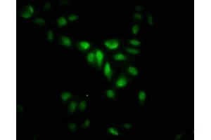 Immunofluorescence staining of Hela cells with ABIN7158992 at 1: 266, counter-stained with DAPI. (MAPKAP Kinase 5 Antikörper  (AA 200-471))