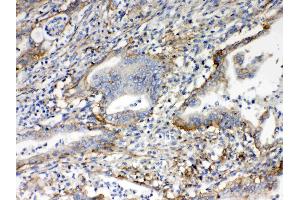 IHC analysis of CD151 using anti- CD151 antibody . (CD151 Antikörper  (AA 113-175))
