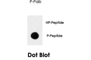 Dot blot analysis of NTRK1 (phospho Y791) polyclonal antibody  on nitrocellulose membrane.