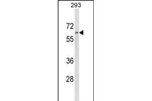 Dolichol Kinase Antikörper  (AA 312-339)