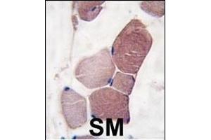 Formalin-fixed and paraffin-embedded human skeletal muscle tissue reacted with UCHL3 Antibody (C-term) (ABIN1882147 and ABIN2839167) , which was peroxidase-conjugated to the secondary antibody, followed by DAB staining. (UCHL3 Antikörper  (C-Term))