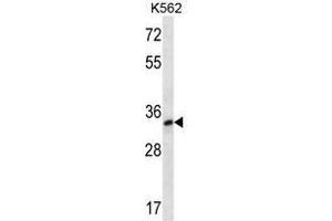 LOC728395 Antibody (C-term) western blot analysis in K562 cell line lysates (35 µg/lane). (TSPY1 Antikörper  (C-Term))