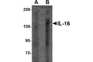 Western Blotting (WB) image for anti-Interleukin 16 (IL16) (N-Term) antibody (ABIN1031693) (IL16 Antikörper  (N-Term))