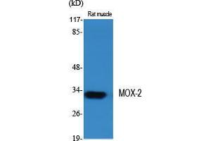 Western Blot (WB) analysis of specific cells using MOX-2 Polyclonal Antibody. (NOX3 Antikörper  (Internal Region))