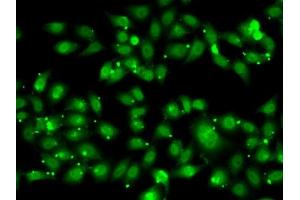 Immunofluorescence analysis of MCF7 cells using NR2C1 antibody (ABIN6128389, ABIN6144809, ABIN6144810 and ABIN6222379). (NR2C1 Antikörper  (AA 1-240))
