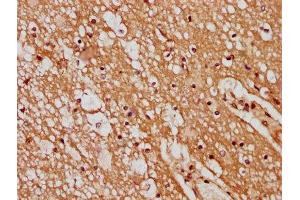 IHC image of ABIN7165614 diluted at 1:400 and staining in paraffin-embedded human brain tissue performed on a Leica BondTM system. (GPR17 Antikörper  (AA 151-262))