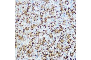Immunohistochemistry of paraffin-embedded rat ovary using RSPO1 Rabbit pAb (ABIN6132958, ABIN6147279, ABIN6147280 and ABIN6224304) at dilution of 1:100 (40x lens). (RSPO1 Antikörper  (AA 21-263))