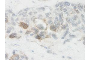 Image no. 2 for anti-Nephroblastoma Overexpressed (NOV) antibody (ABIN465355)