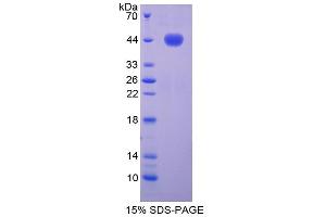 SDS-PAGE analysis of Mouse Noggin Protein. (NOG Protein)