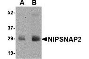 Western Blotting (WB) image for anti-Glioblastoma Amplified Sequence (GBAS) (N-Term) antibody (ABIN1031480) (GBAS Antikörper  (N-Term))