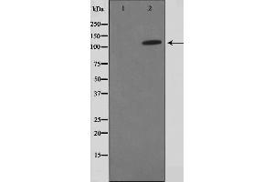 Western blot analysis on HuvEc cell lysate using FIR Antibody,The lane on the left is treated with the antigen-specific peptide. (FARP2 Antikörper  (Internal Region))
