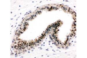 Immunohistochemistry (IHC) image for anti-Valosin Containing Protein (VCP) (C-Term) antibody (ABIN3029567)