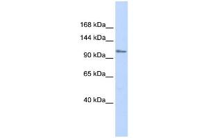 WB Suggested Anti-ZFPM1 Antibody Titration:  0. (ZFPM1 Antikörper  (Middle Region))