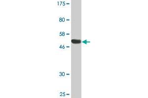 Western Blot detection against Immunogen (51. (RGS18 Antikörper  (AA 1-235))