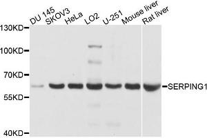 Western blot analysis of extracts of various cells, using SERPING1 antibody. (SERPING1 Antikörper)