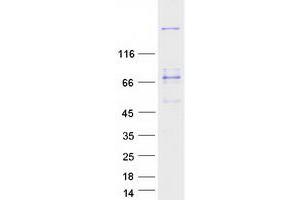 Western Blotting (WB) image for Myosin Heavy Chain 3, Skeletal Muscle, Embryonic (MYH3) protein (Myc-DYKDDDDK Tag) (ABIN2726711)