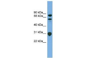 WB Suggested Anti-SH3KBP1 Antibody Titration: 0. (SH3KBP1 Antikörper  (N-Term))