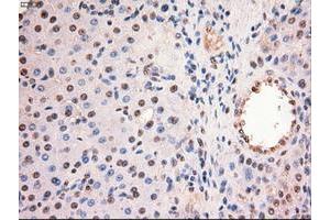 Image no. 5 for anti-Myc Proto-Oncogene protein (MYC) antibody (ABIN1497013) (c-MYC Antikörper)
