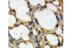 IHC-P analysis of Lung tissue, with DAB staining. (TICAM2 Antikörper  (AA 34-241))