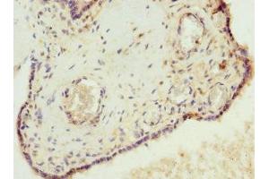 Immunohistochemistry of paraffin-embedded human placenta tissue using ABIN7175638 at dilution of 1:100 (VHLL Antikörper  (AA 1-139))