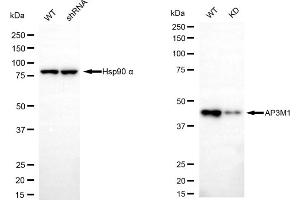 Western blotting analysis using AP3M1 antibody (ABIN7797512). (Rekombinanter AP3M1 Antikörper)
