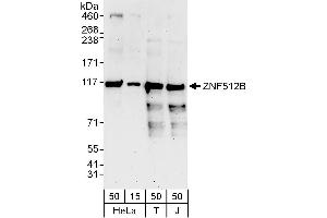 anti-Zinc Finger Protein 512B (ZNF512B) (AA 450-500) antibody