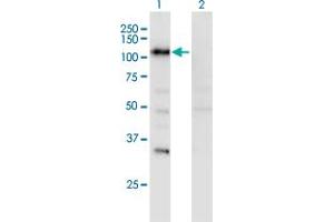 Western Blot analysis of SECISBP2 expression in transfected 293T cell line by SECISBP2 monoclonal antibody (M08), clone 3A7. (SECISBP2 Antikörper  (AA 106-205))
