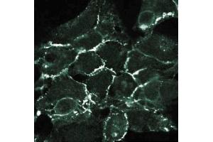 Immunofluorescent staining of 293 cells with anti-N-Cadherin. (N-Cadherin Antikörper  (AA 802-819))